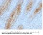 Anti-Beta-2 Microglobulin (Renal Failure & Tumor Marker) B2M Monoclonal Antibody