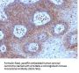 Anti-Beta-2 Microglobulin (Renal Failure & Tumor Marker) B2M Monoclonal Antibody