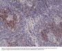Anti-Integrin alpha 4 (ITGA4) Rabbit Monoclonal Antibody, Clone#RM268