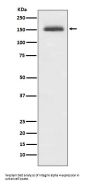 Anti-Integrin alpha 4 ITGA4 Rabbit Monoclonal Antibody