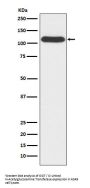 Anti-OGT Monoclonal Antibody