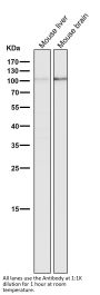 Anti-DGCR8 Rabbit Monoclonal Antibody