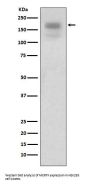 Anti-MERTK/Mer Rabbit Monoclonal Antibody