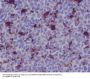 Anti-MERTK/Mer Rabbit Monoclonal Antibody