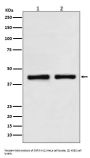 Anti-SNF5 SMARCB1 Rabbit Monoclonal Antibody