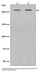 Anti-Filamin A FLNA Rabbit Monoclonal Antibody