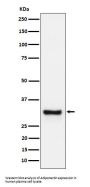 Anti-Adiponectin Rabbit Monoclonal Antibody