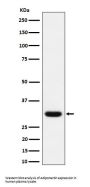 Anti-Adiponectin Rabbit Monoclonal Antibody