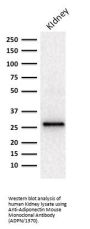 Anti-Adiponectin (Marker of Obesity) Monoclonal Antibody
