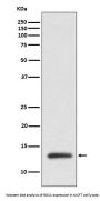 Anti-ROC1 Monoclonal Antibody