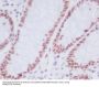 Anti-KDM1/LSD1 KDM1A Rabbit Monoclonal Antibody