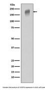 Anti-VEGF Receptor 1 FLT1 Rabbit Monoclonal Antibody