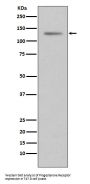 Anti-Progesterone Receptor PGR Rabbit Monoclonal Antibody