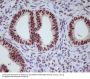 Anti-Progesterone Receptor PGR Rabbit Monoclonal Antibody