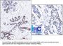 Anti-Progesterone Receptor (Marker of Progestin Dependence) PGR Monoclonal Antibody
