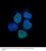 Anti-Androgen Receptor AR Rabbit Monoclonal Antibody