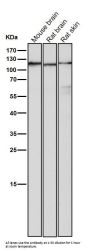 Anti-Androgen Receptor AR Rabbit Monoclonal Antibody
