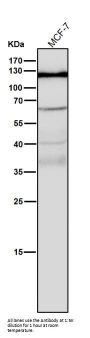 Anti-Androgen Receptor AR Rabbit Monoclonal Antibody