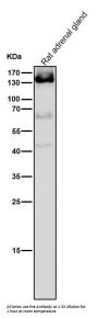 Anti-Androgen Receptor AR Rabbit Monoclonal Antibody