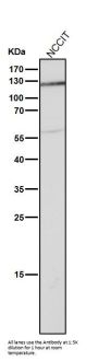 Anti-Androgen Receptor AR Rabbit Monoclonal Antibody