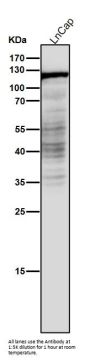 Anti-Androgen Receptor AR Rabbit Monoclonal Antibody