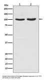 Anti-Androgen Receptor AR Rabbit Monoclonal Antibody