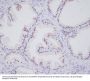 Anti-Androgen Receptor AR Rabbit Monoclonal Antibody
