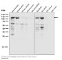 Anti-Androgen Receptor AR Rabbit Monoclonal Antibody
