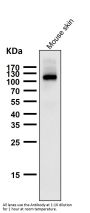 Anti-Androgen Receptor AR Rabbit Monoclonal Antibody
