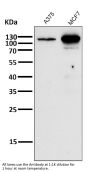 Anti-Androgen Receptor AR Rabbit Monoclonal Antibody