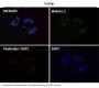 Anti-Androgen Receptor AR Rabbit Monoclonal Antibody
