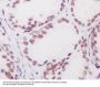 Anti-Androgen Receptor AR Rabbit Monoclonal Antibody