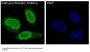 Anti-Androgen Receptor AR Rabbit Monoclonal Antibody
