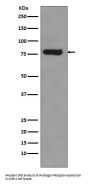 Anti-Androgen Receptor (AR-V7 specific) Rabbit Monoclonal Antibody