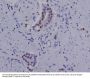 Anti-Androgen Receptor (AR-V7 specific) Rabbit Monoclonal Antibody