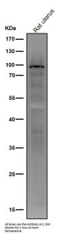 Anti-Androgen Receptor (AR-V7 specific) Rabbit Monoclonal Antibody