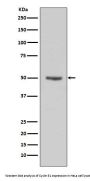 Anti-Cyclin E1 CCNE1 Rabbit Monoclonal Antibody