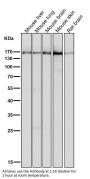 Anti-MSH6/Gtbp Rabbit Monoclonal Antibody