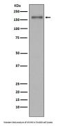 Anti-MSH6/Gtbp Rabbit Monoclonal Antibody