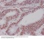 Anti-MSH6/Gtbp Rabbit Monoclonal Antibody