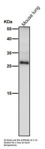 Anti-TIMP1 Rabbit Monoclonal Antibody