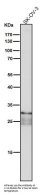 Anti-TIMP1 Rabbit Monoclonal Antibody