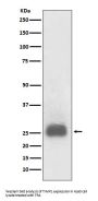 Anti-TIMP1 Rabbit Monoclonal Antibody