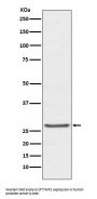 Anti-TIMP1 Rabbit Monoclonal Antibody