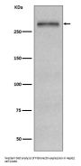 Anti-Fibronectin FN1 Rabbit Monoclonal Antibody