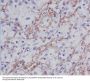 Anti-Fibronectin FN1 Rabbit Monoclonal Antibody