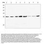 Anti-GSTM1 Antibody Picoband® (monoclonal, 11F2)