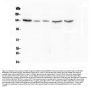 Anti-CASR Antibody Picoband® (monoclonal, 11E9)