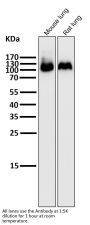 Anti-Integrin beta 3 ITGB3 Rabbit Monoclonal Antibody