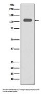 Anti-Integrin beta 3 ITGB3 Rabbit Monoclonal Antibody